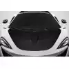 2016-2020 Mclaren 540c 570s 570GT Carbon Creations Boost Hood - 1 Piece - Image 1